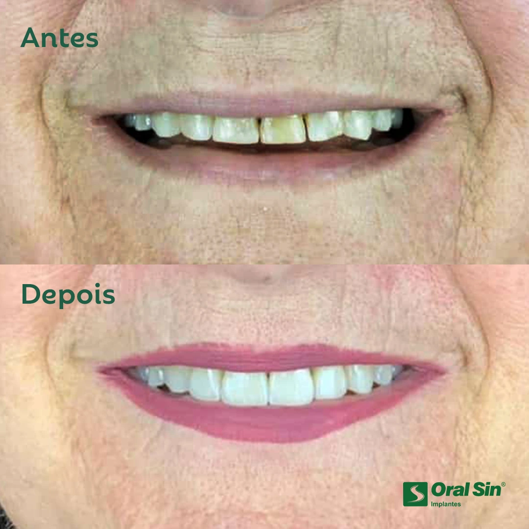 antes-e-depois-cacho.webp